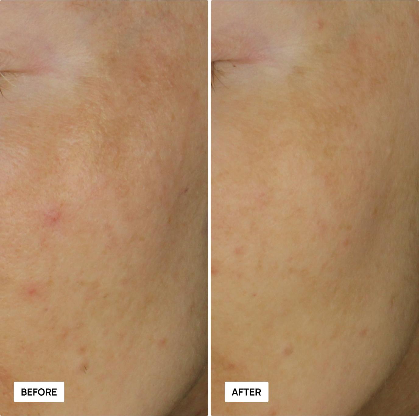 Before and after